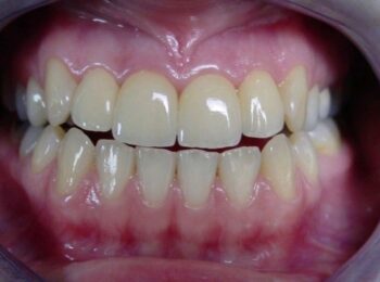 IMG-4e9e16215cad5198a65ebef0d2d0ac03-V